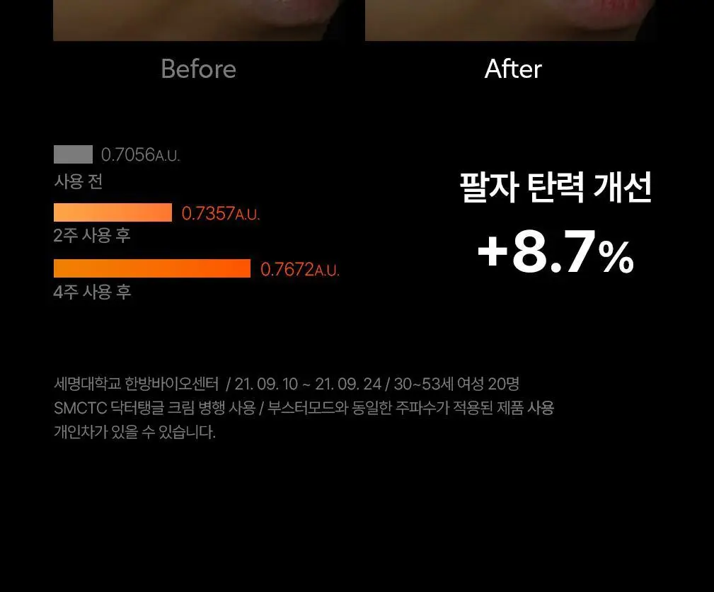 닥터탱글 고주파 마사지기 블랙 에디션 상세페이지 37