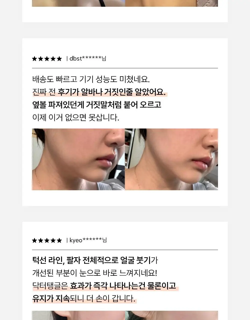 닥터탱글 고주파 뷰티 디바이스 (탄력, 수분, 볼륨, 모공개선) 상세페이지 10