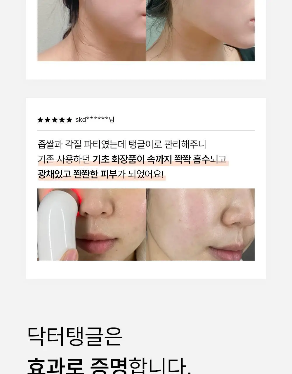 닥터탱글 고주파 뷰티 디바이스 (탄력, 수분, 볼륨, 모공개선) 상세페이지 11