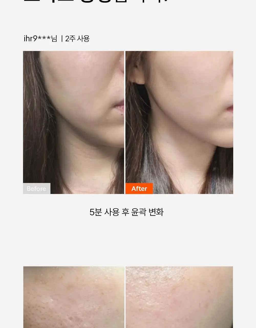 닥터탱글 고주파 뷰티 디바이스 (탄력, 수분, 볼륨, 모공개선) 상세페이지 12