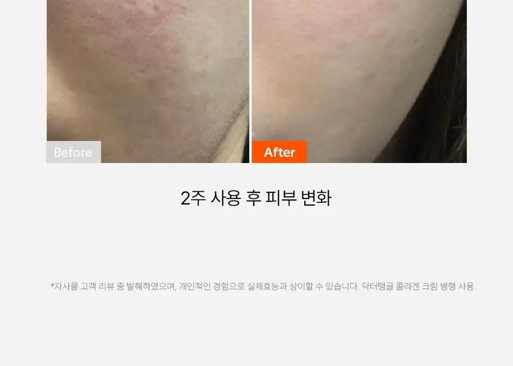 닥터탱글 고주파 뷰티 디바이스 (탄력, 수분, 볼륨, 모공개선) 상세페이지 13