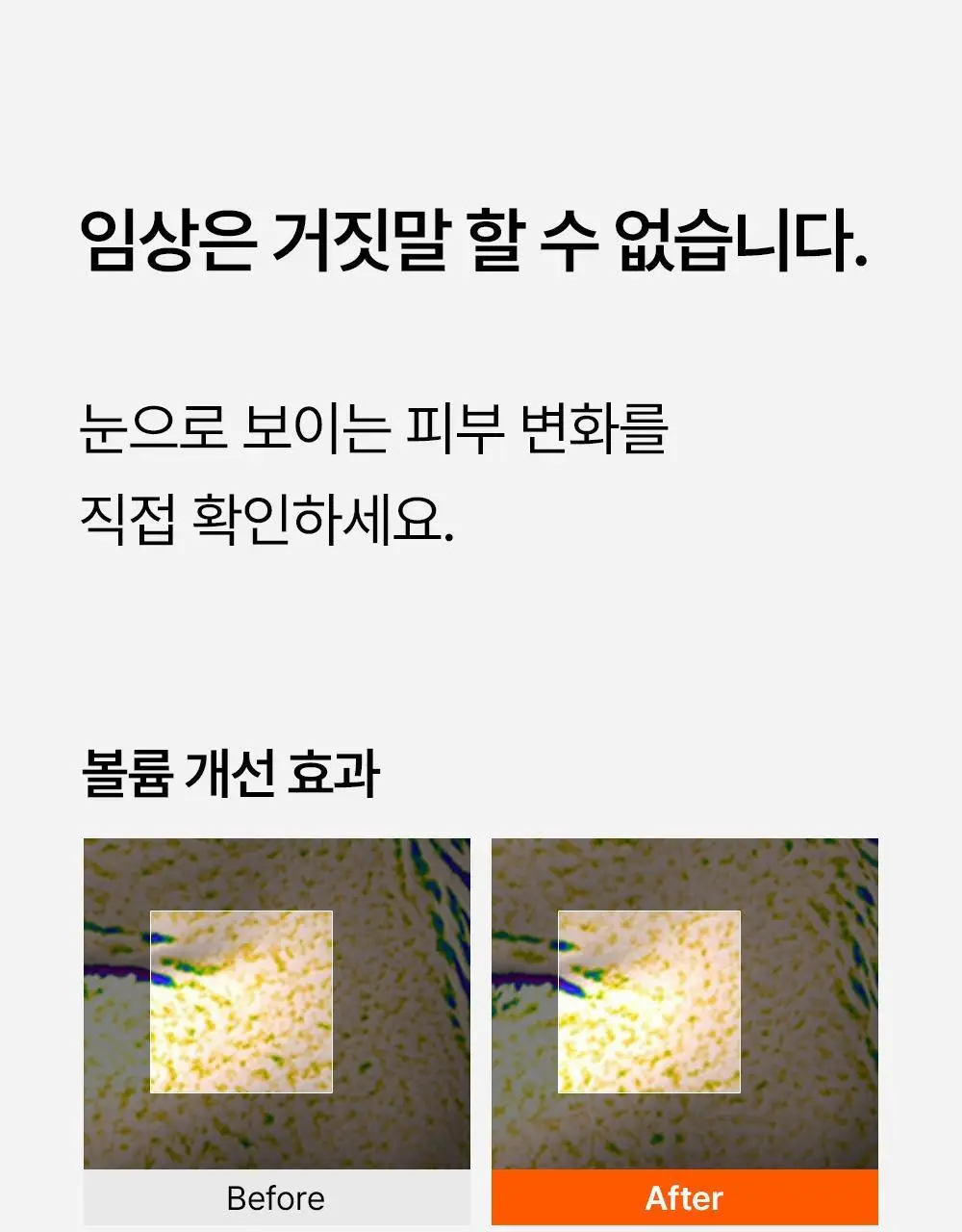 닥터탱글 고주파 뷰티 디바이스 (탄력, 수분, 볼륨, 모공개선) 상세페이지 16