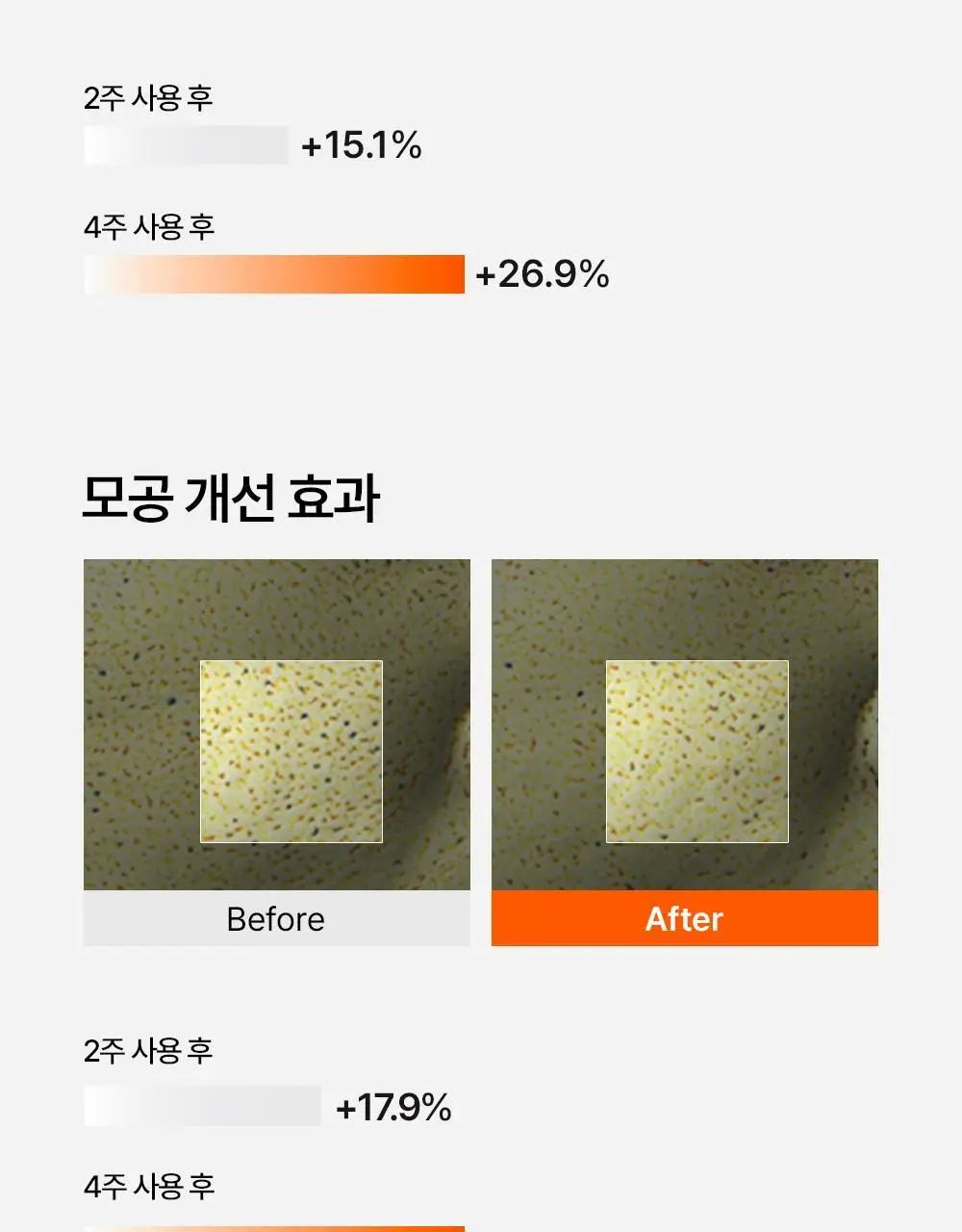 닥터탱글 고주파 뷰티 디바이스 (탄력, 수분, 볼륨, 모공개선) 상세페이지 17