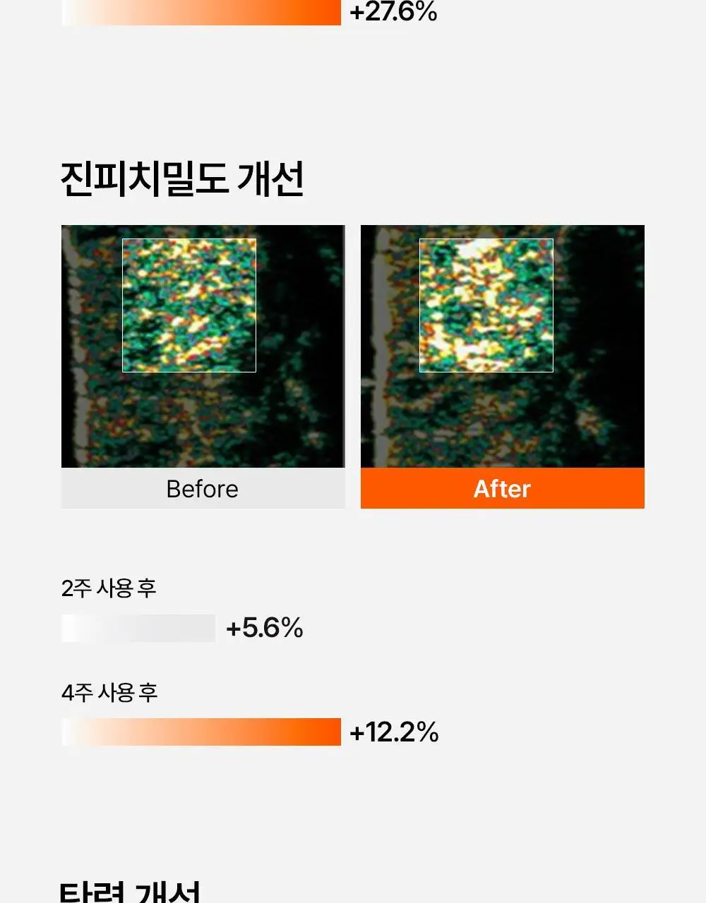 닥터탱글 고주파 뷰티 디바이스 (탄력, 수분, 볼륨, 모공개선) 상세페이지 18