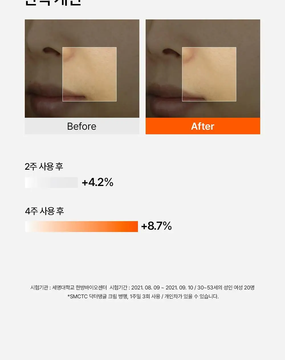 닥터탱글 고주파 뷰티 디바이스 (탄력, 수분, 볼륨, 모공개선) 상세페이지 19