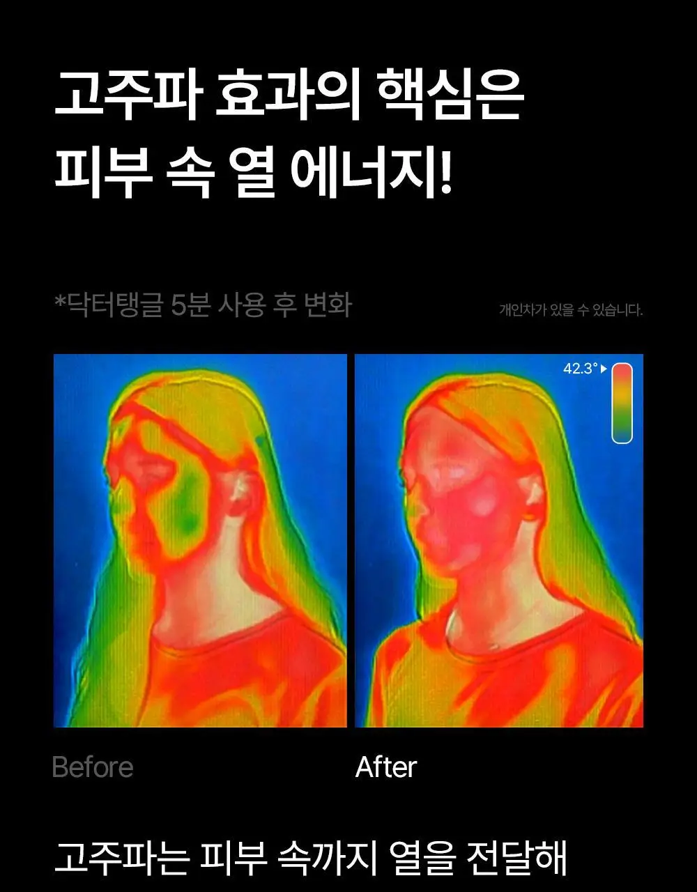 닥터탱글 고주파 뷰티 디바이스 (탄력, 수분, 볼륨, 모공개선) 상세페이지 29