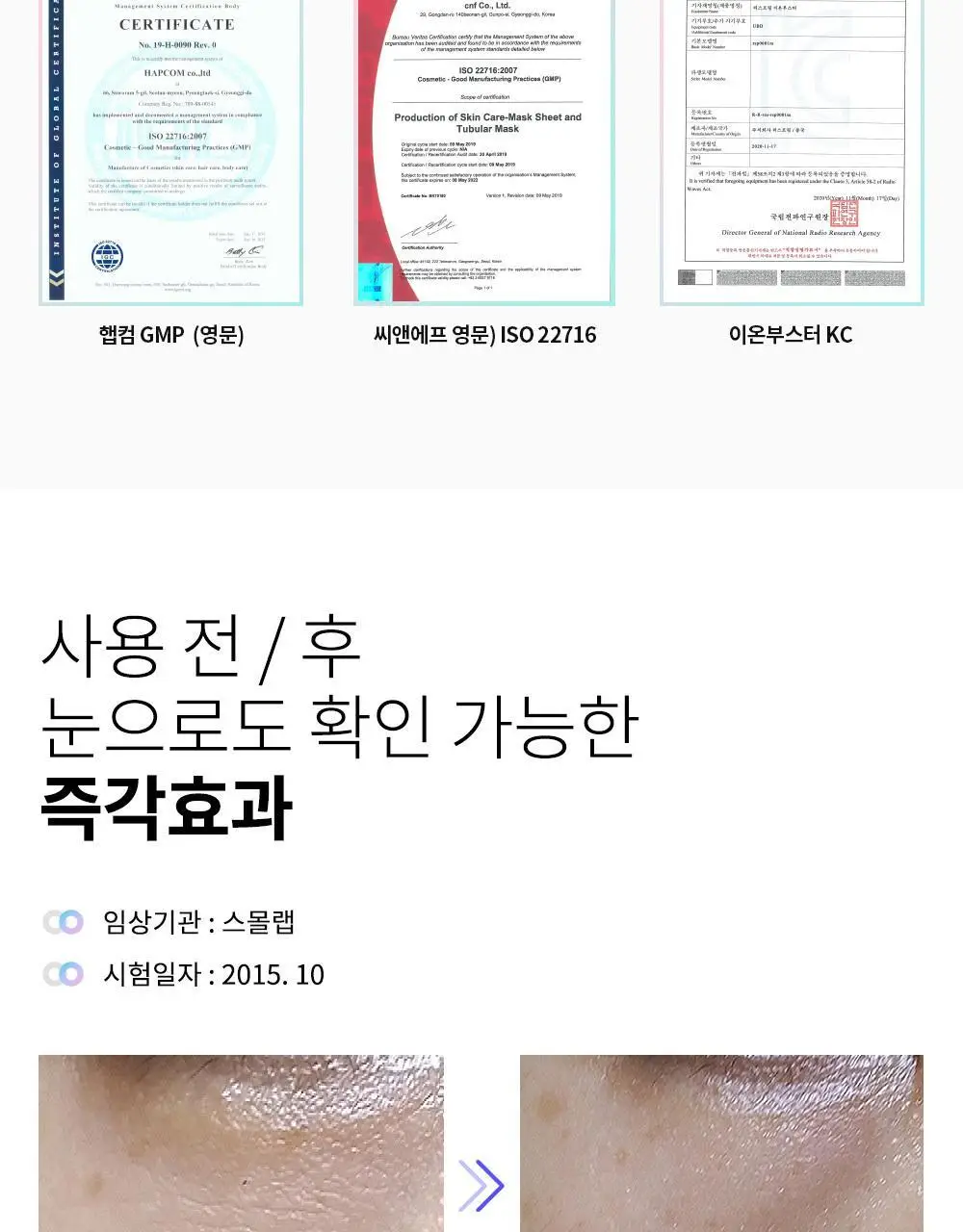 리스프링 시카니들 MTS 리필 키트 상세페이지 14