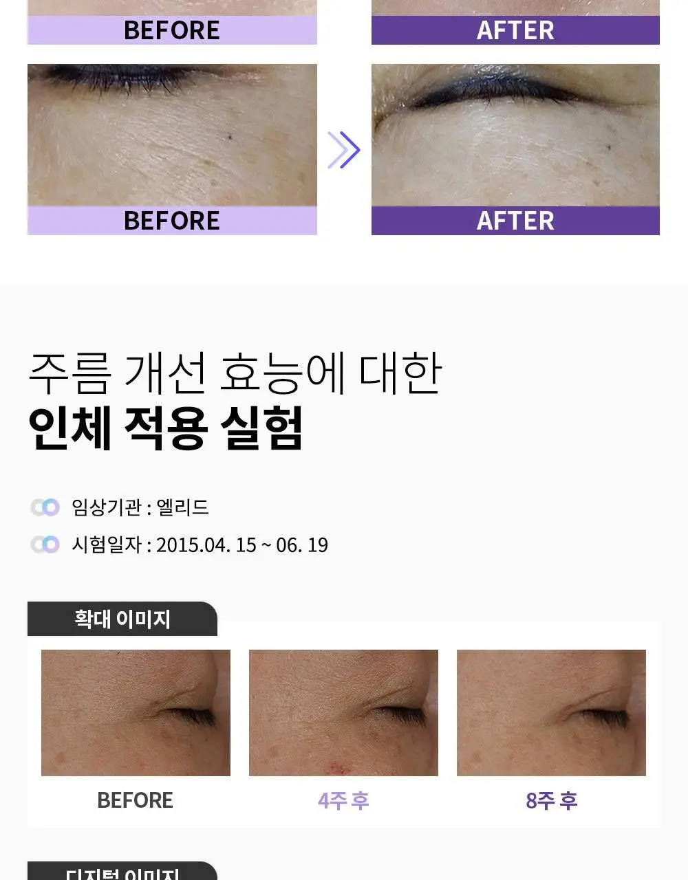 리스프링 시카니들 MTS 리필 키트 상세페이지 15