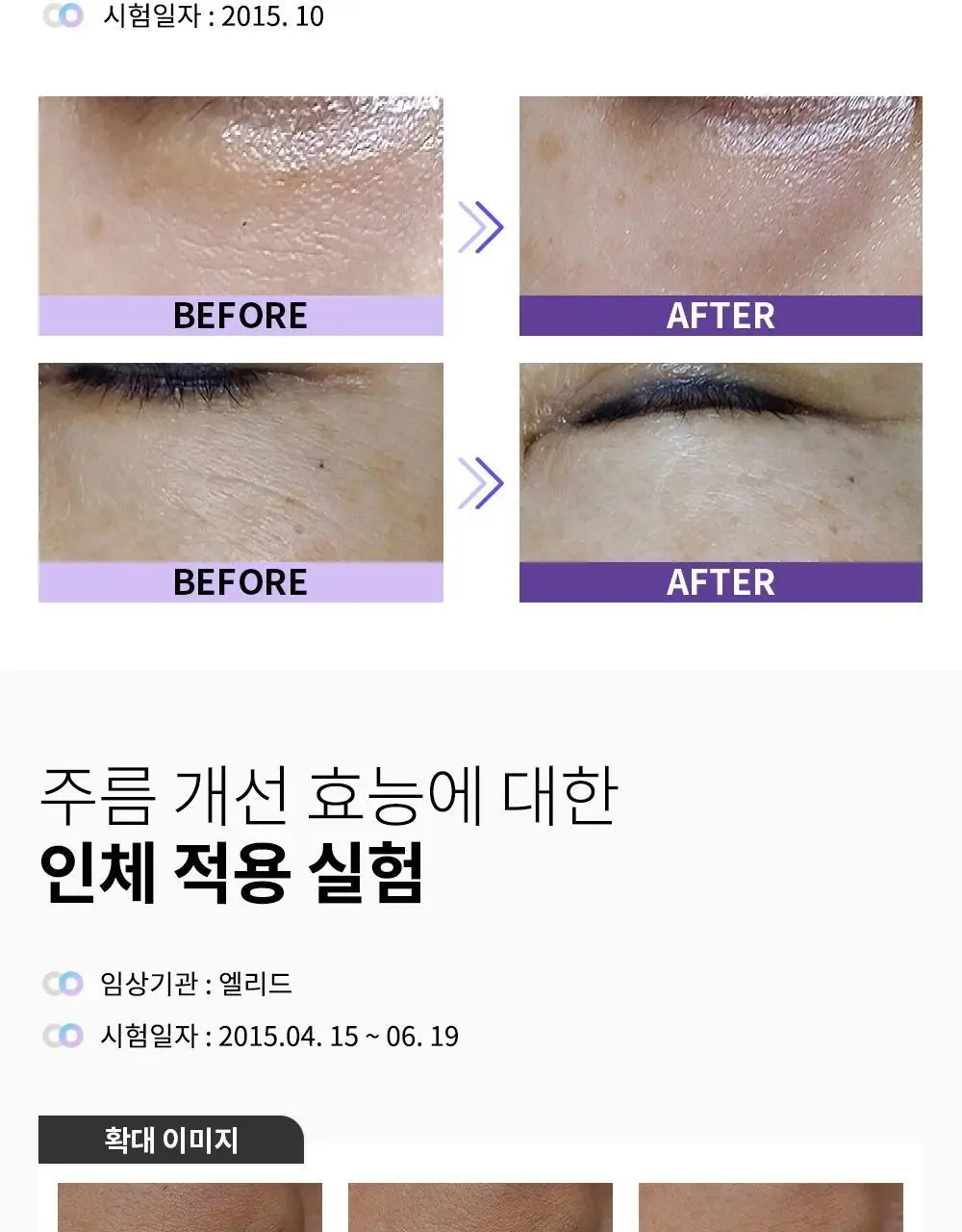 리스프링 시카니들 MTS 스타터 키트 상세페이지 15