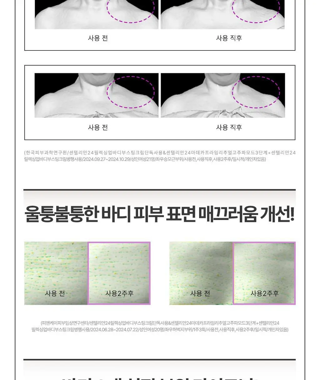 센텔리안24 마데카 프라임 리추얼 화이트 펄 (고주파 괄사 디바이스) 상세페이지 30