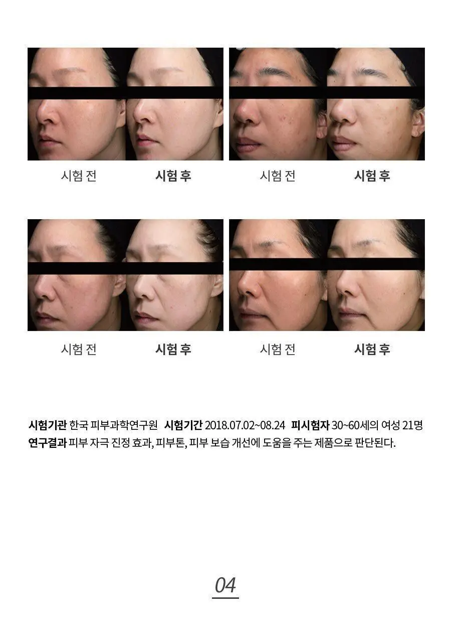 페이스팩토리 미용가전 3종 (필링기, 피지 흡입기, 셀라이너) 상세페이지 26