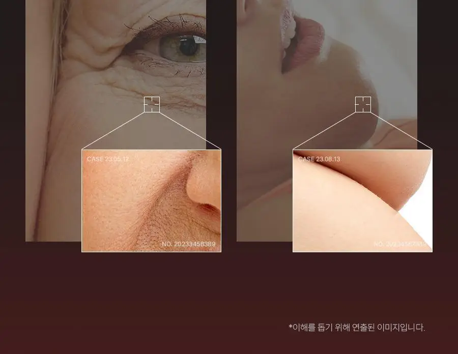 페이스팩토리 미용가전 3종 (필링기, 피지 흡입기, 셀라이너) 상세페이지 43