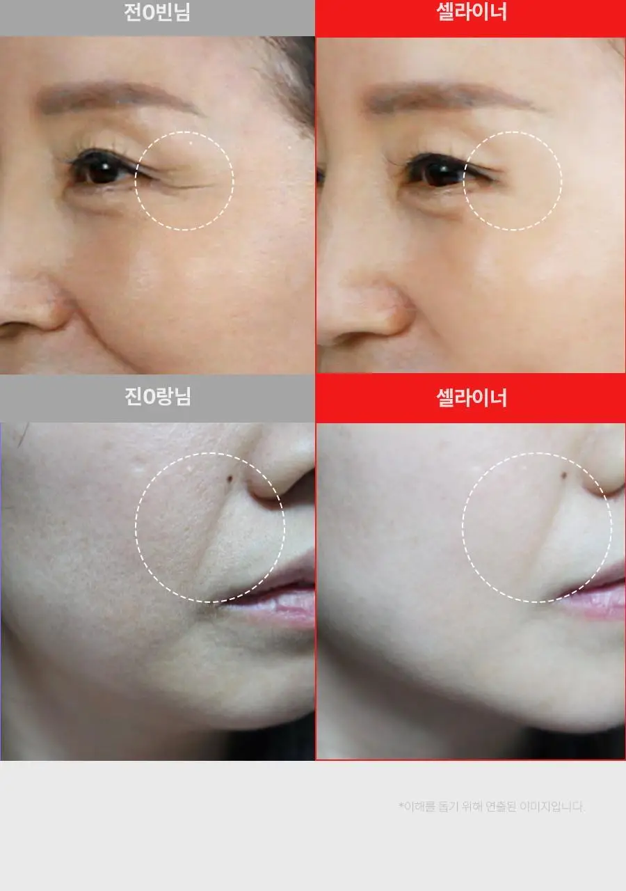 페이스팩토리 미용가전 3종 (필링기, 피지 흡입기, 셀라이너) 상세페이지 45
