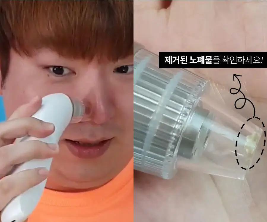 페이스팩토리 미용가전 3종 (필링기, 피지 흡입기, 셀라이너) 상세페이지 82
