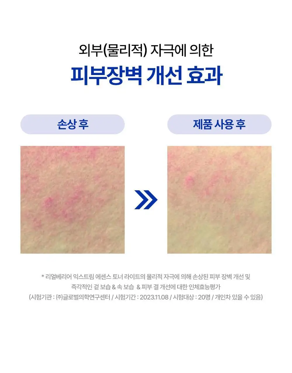 리얼베리어 익스트림 에센스 토너 라이트 300ml 기획 (+라이트 크림 25ml) 상세페이지 17