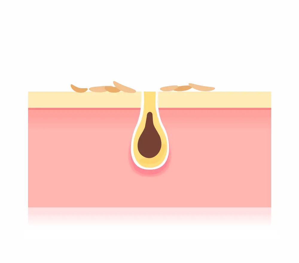 토리든 밸런스풀 시카 각질 토너 250ml 상세페이지 18