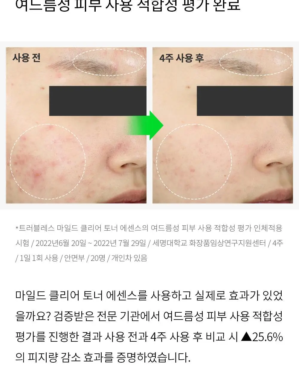 트러블레스 마일드 클리어 토너 에센스 200ml 상세페이지 20