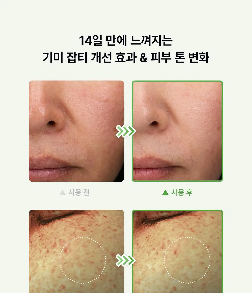 닥터엘시아 젠틀 비타민 C 부스팅 세럼 30ml 상세페이지 7