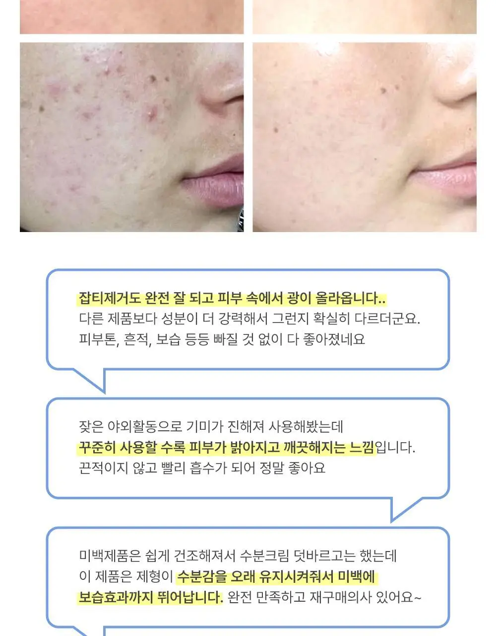 더마라인 디렉소 글루타치온 토닝 솔루션 앰플 35ml 상세페이지 13