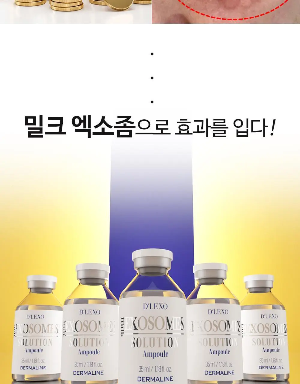 더마라인 디렉소 밀크 엑소좀 솔루션 앰플 35ml 상세페이지 3