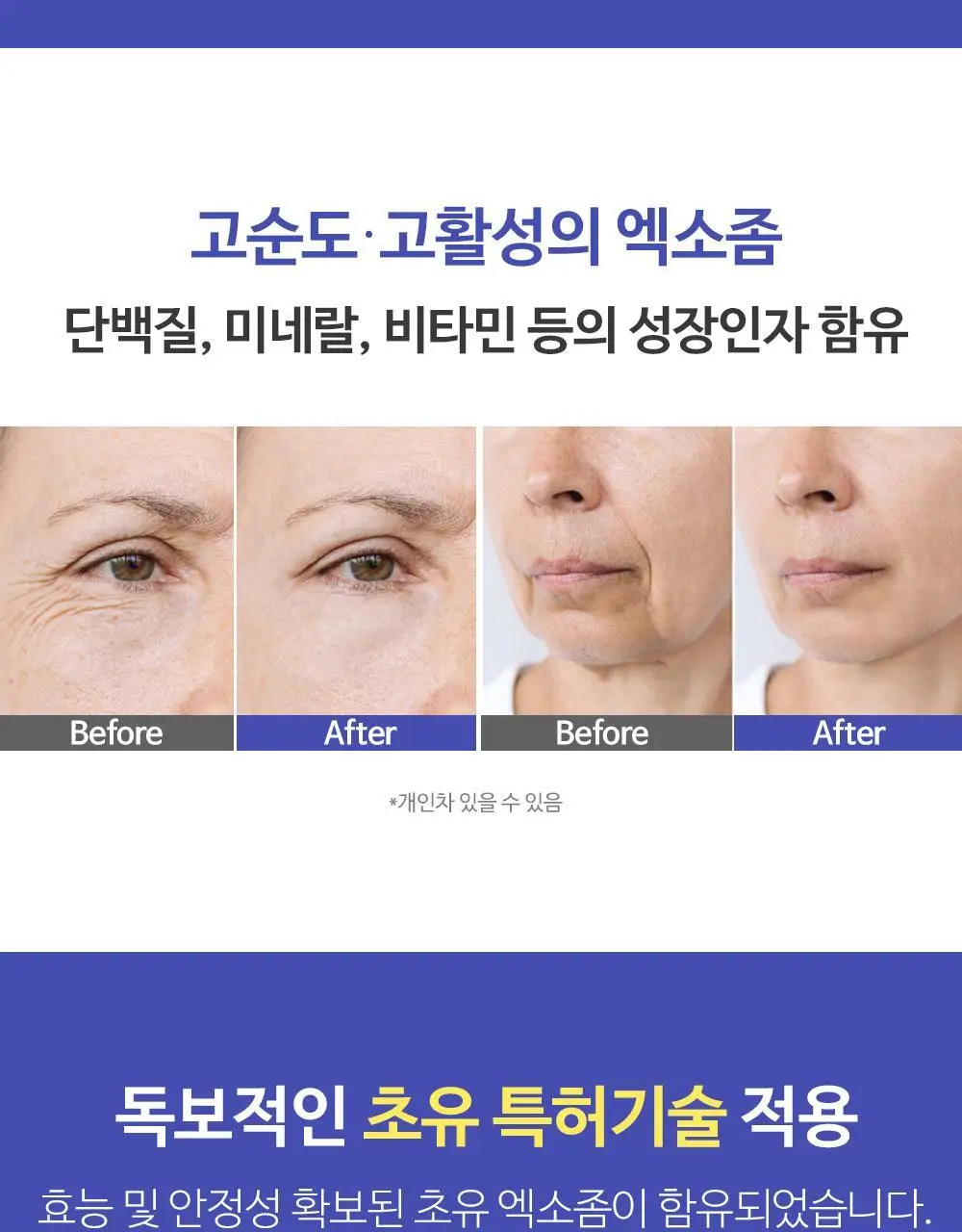 더마라인 디렉소 밀크 엑소좀 솔루션 앰플 35ml 상세페이지 8