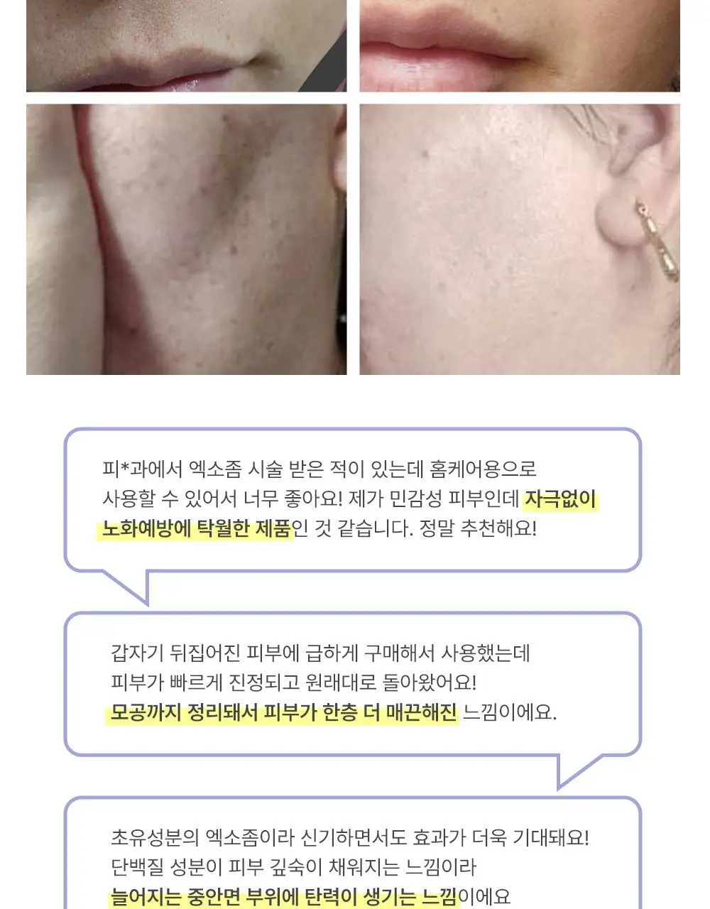 더마라인 디렉소 밀크 엑소좀 솔루션 앰플 35ml 상세페이지 17
