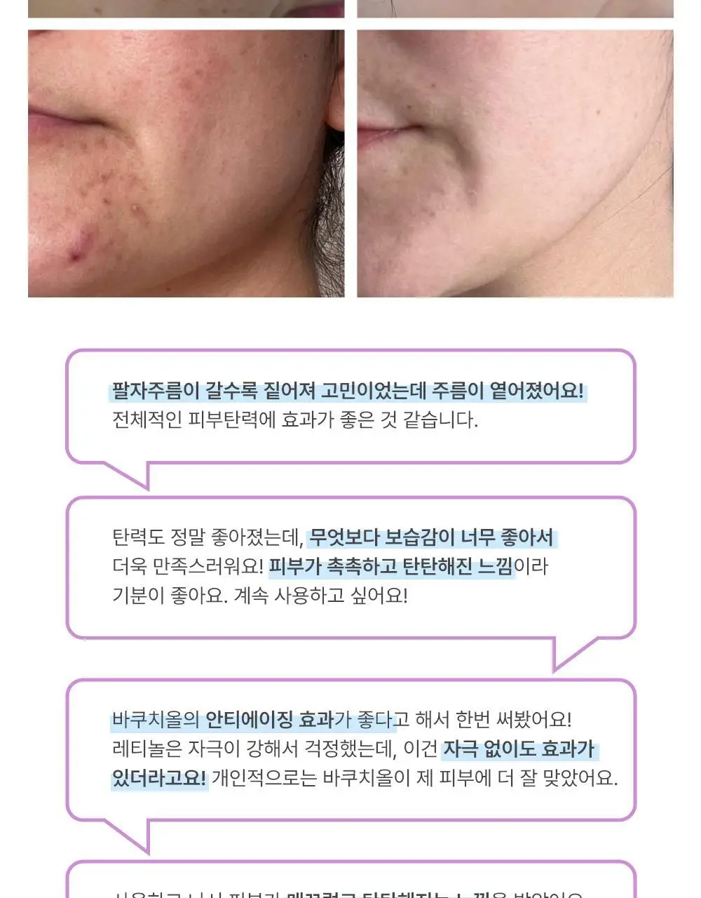 더마라인 디렉소 바쿠치올 퍼밍 솔루션 앰플 35ml 상세페이지 11