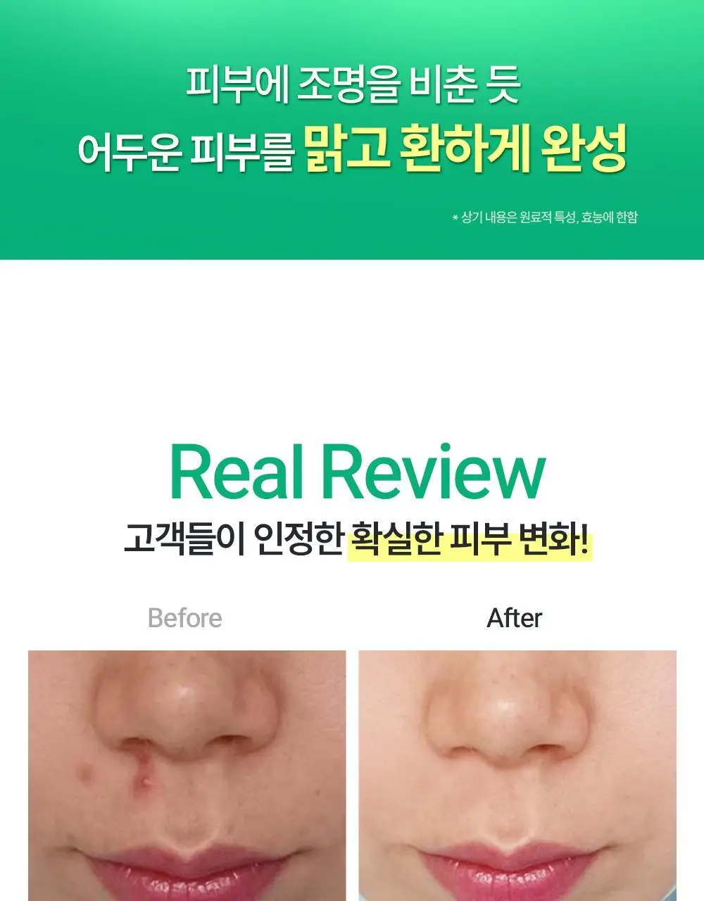 더마라인 디렉소 펩타이드 콤플렉스 솔루션 앰플 35ml 상세페이지 10