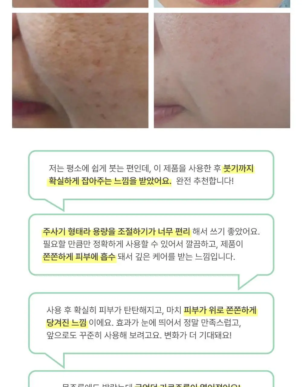 더마라인 디렉소 펩타이드 콤플렉스 솔루션 앰플 35ml 상세페이지 11