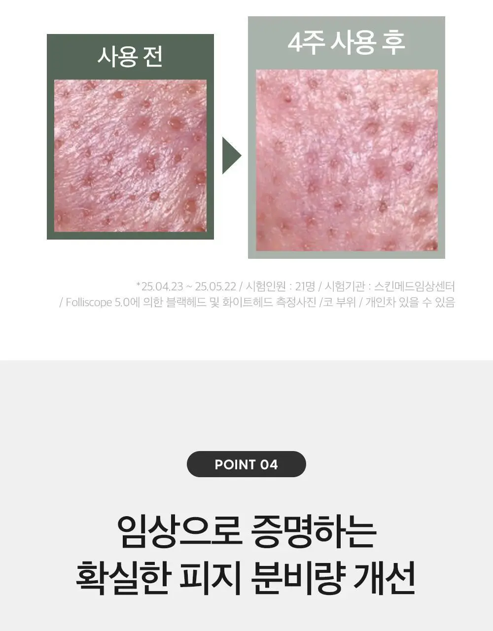 더마팩토리 나이아신아마이드 20% 세럼 30ml 상세페이지 13