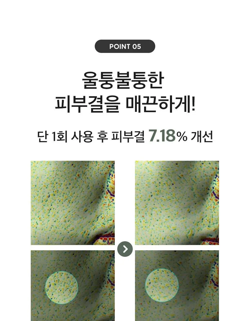 더마팩토리 나이아신아마이드 20% 세럼 30ml 상세페이지 15