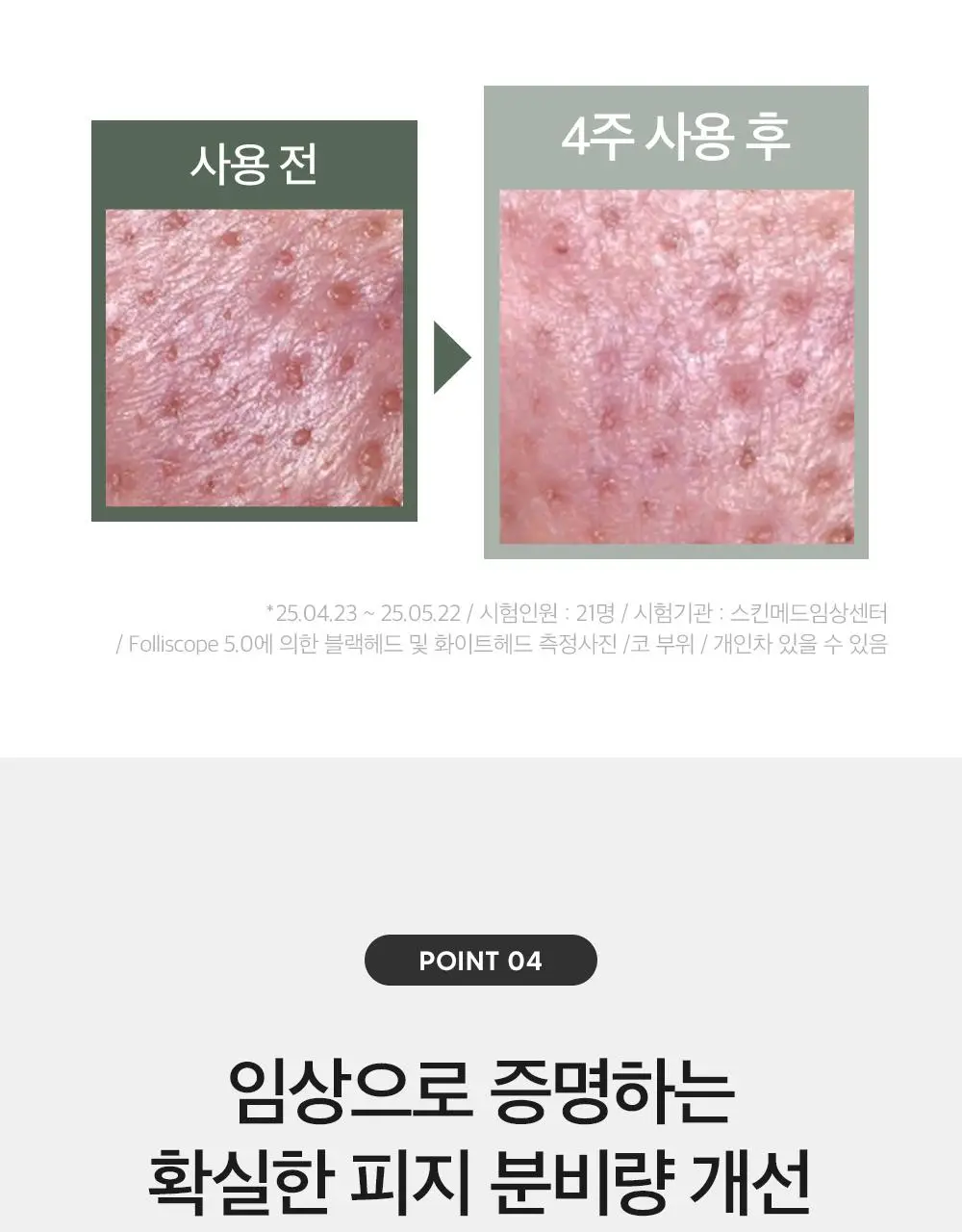 더마팩토리 나이아신아마이드 20% 세럼 80ml (한글에디션) 상세페이지 10