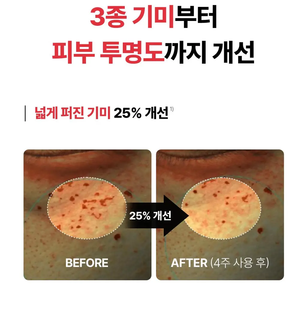 동국제약 멜라-셋 기미 토닝 크리미 에센스 100ml 기획 (+크림 10ml+패치 2매) (2608) 상세페이지 15