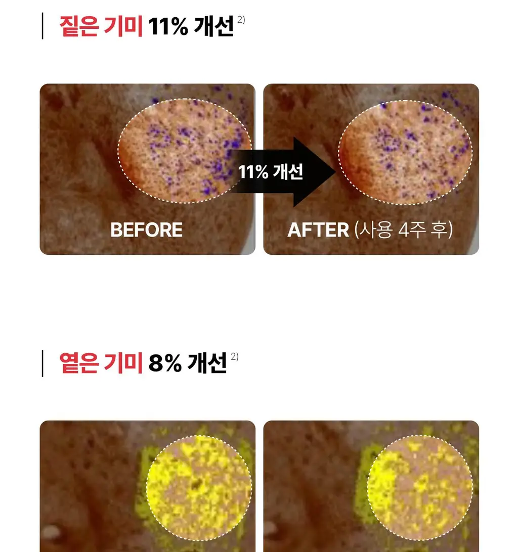 동국제약 멜라-셋 기미 토닝 크리미 에센스 100ml 기획 (+크림 10ml+패치 2매) (2608) 상세페이지 16