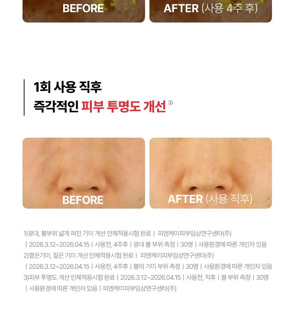 동국제약 멜라-셋 기미 토닝 크리미 에센스 100ml 기획 (+크림 10ml+패치 2매) (2608) 상세페이지 17