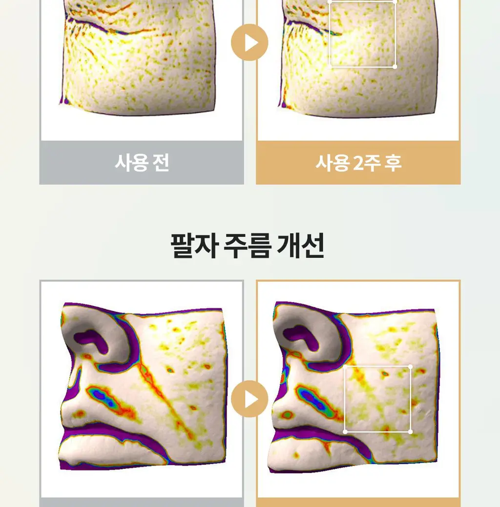 리쥬란 힐러 턴오버 앰플 듀얼 이펙트 10ml 더블 한정기획 (+8ml) 상세페이지 21