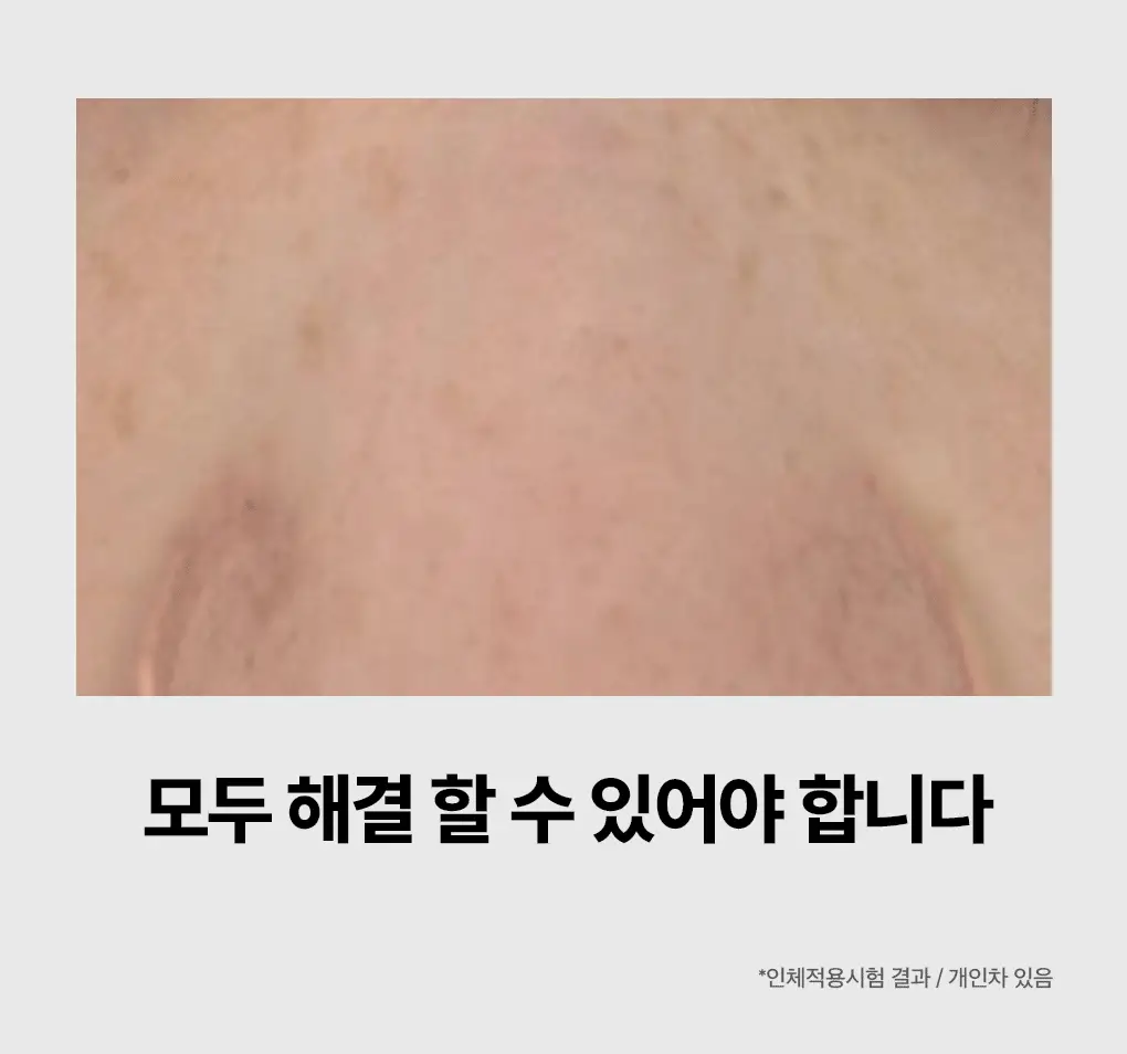 메디힐 마데카소사이드 모공 리페어 스피큘 세럼 40ml 상세페이지 3