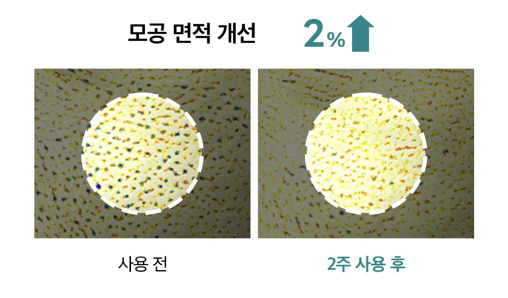 메디힐 마데카소사이드 모공 리페어 스피큘 세럼 40ml 상세페이지 19