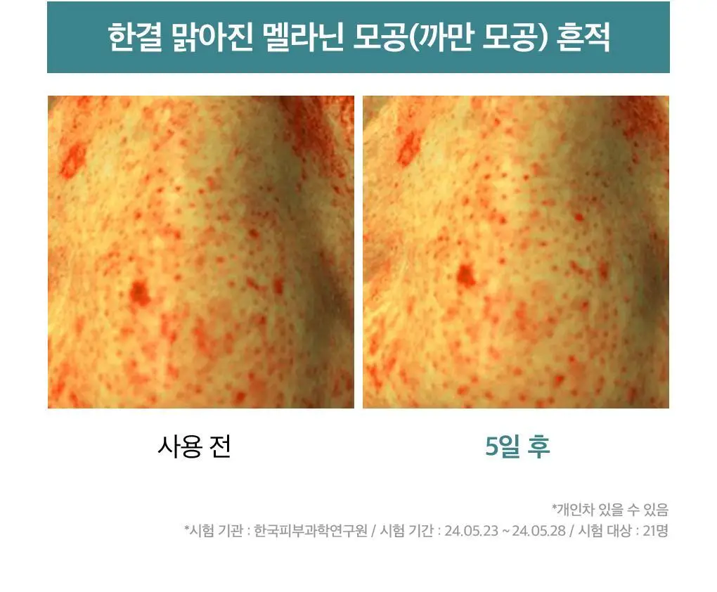 메디힐 마데카소사이드 모공 리페어 스피큘 세럼 40ml 상세페이지 21