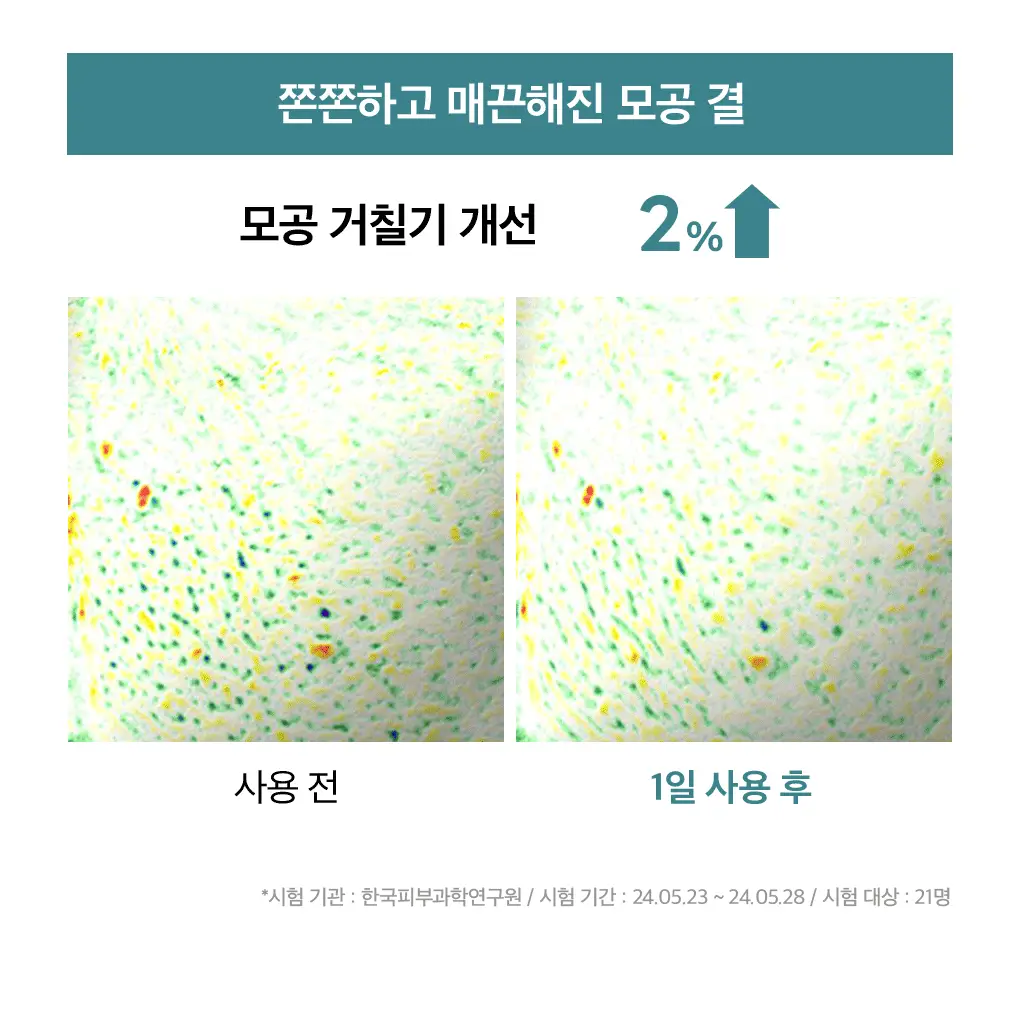 메디힐 마데카소사이드 모공 리페어 스피큘 세럼 40ml 상세페이지 22