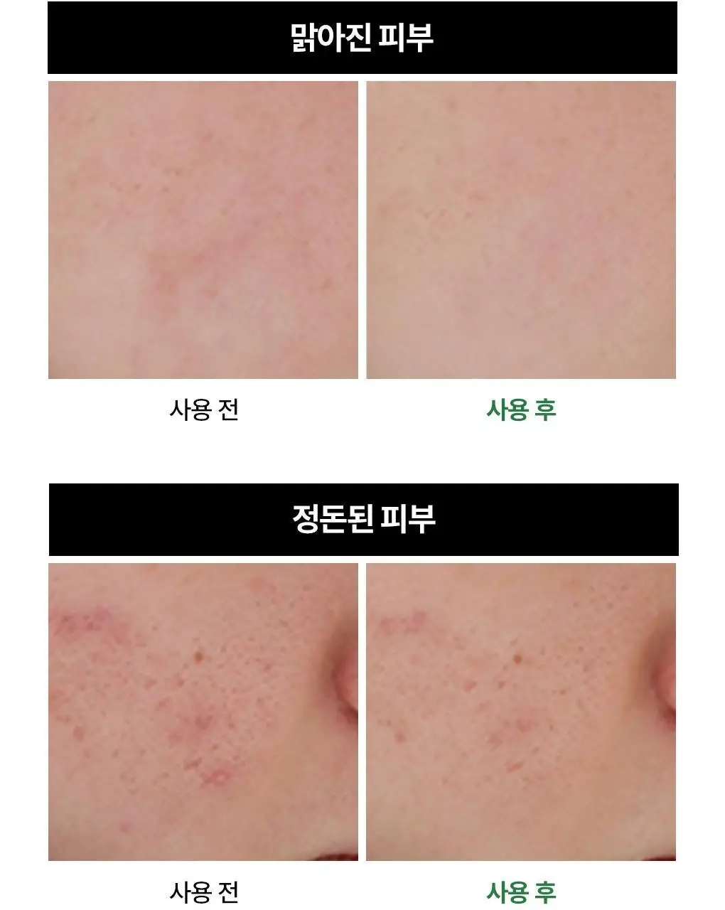 메디힐 티트리 진정 수분 세럼 40ml 상세페이지 4