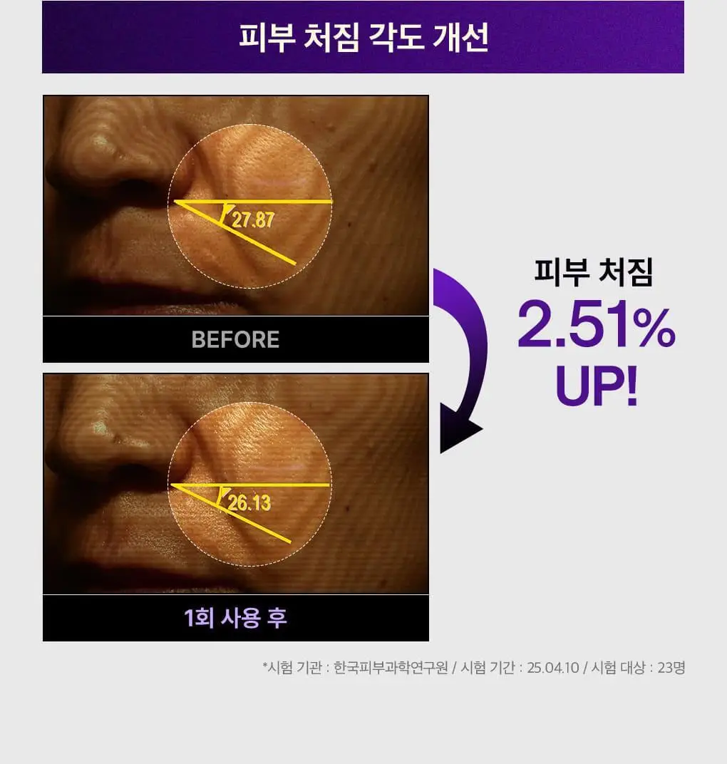 메디힐 PDRN 모공 탄력 세럼 40ml 상세페이지 9