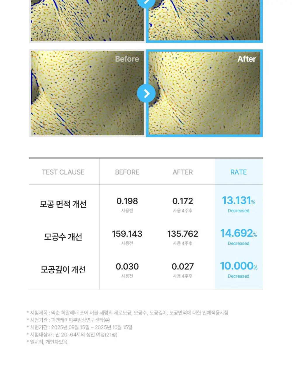 믹순 히알레배 포어 버블 세럼 70ml 기획 (+팩브러쉬) 상세페이지 28