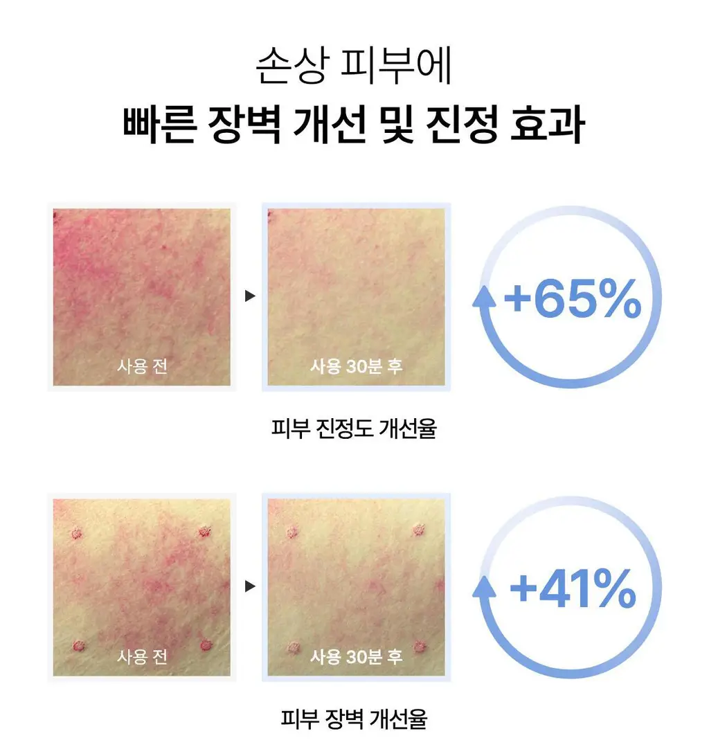 바이오던스 하이드로 세라놀 세럼 30ml 상세페이지 16