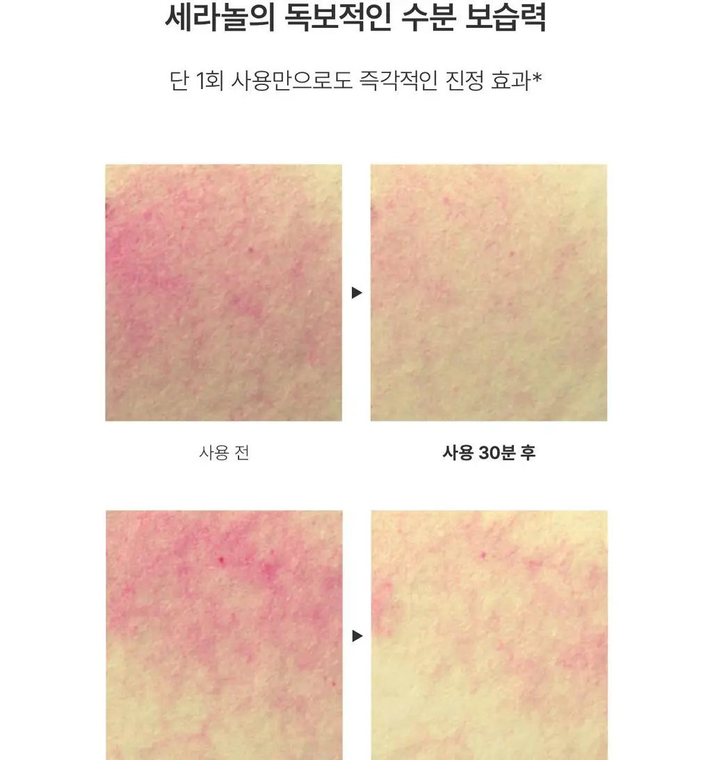 바이오던스 하이드로 세라놀 앰플 30ml 상세페이지 10
