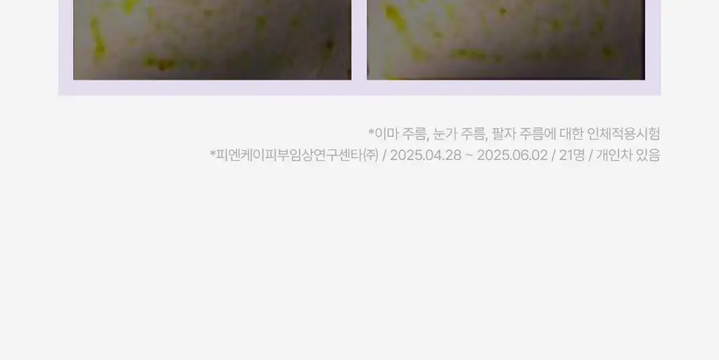 비노트 물톡스 부스터 앰플 30ml 상세페이지 26