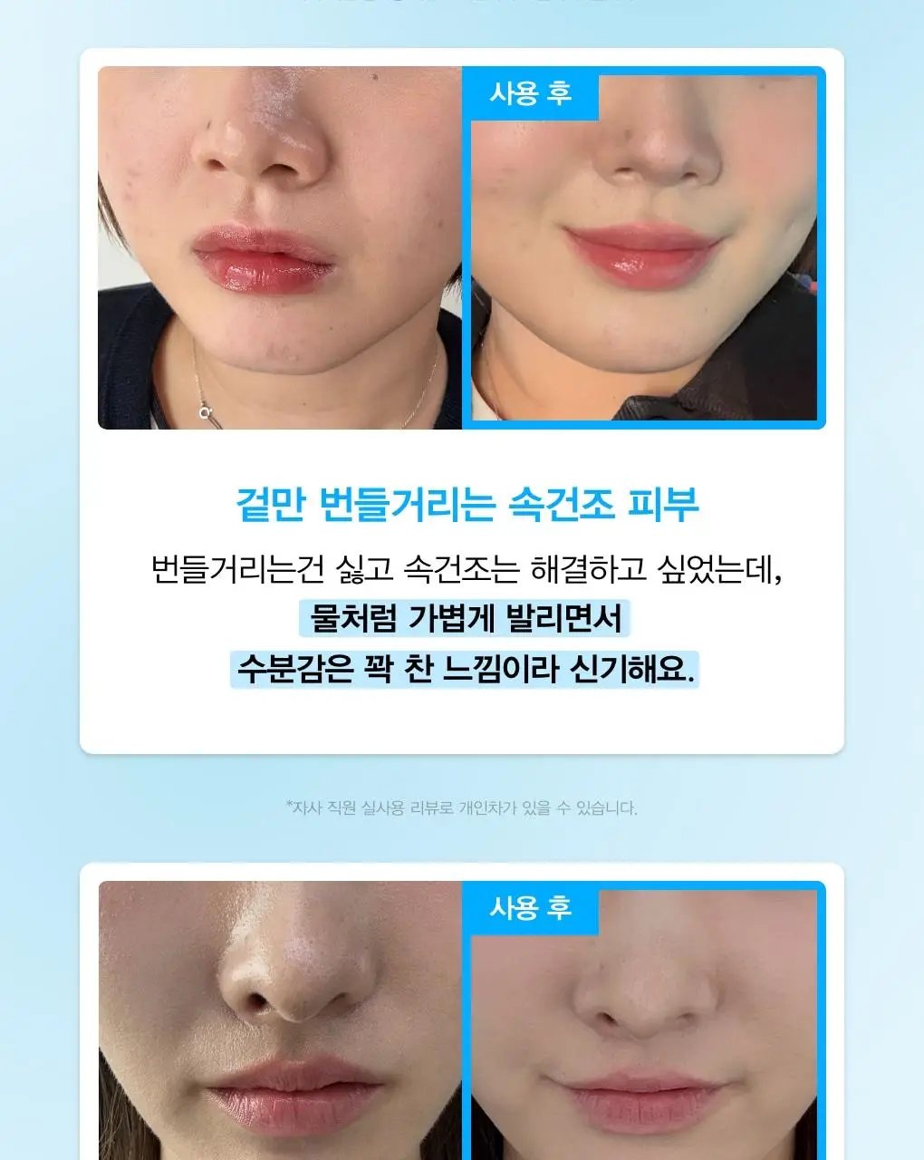 아비브 히알루로닉 붐 세럼 워터드롭 50ml 더블 기획 상세페이지 16