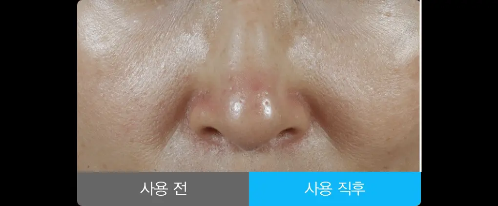 아비브 히알루로닉 붐 세럼 워터드롭 50ml 더블 기획 상세페이지 36