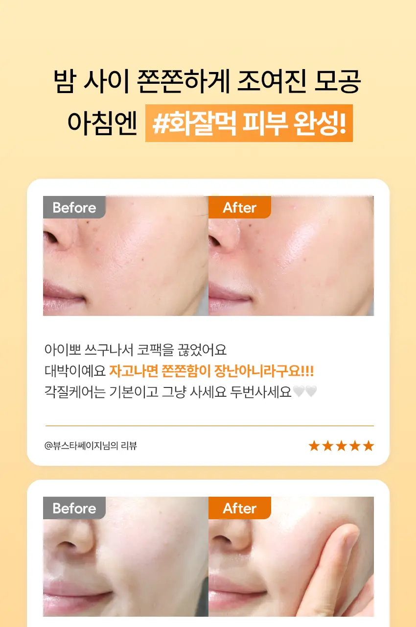 아이뽀 엑스퍼트 모공 앰플 마스크 30ml 상세페이지 1