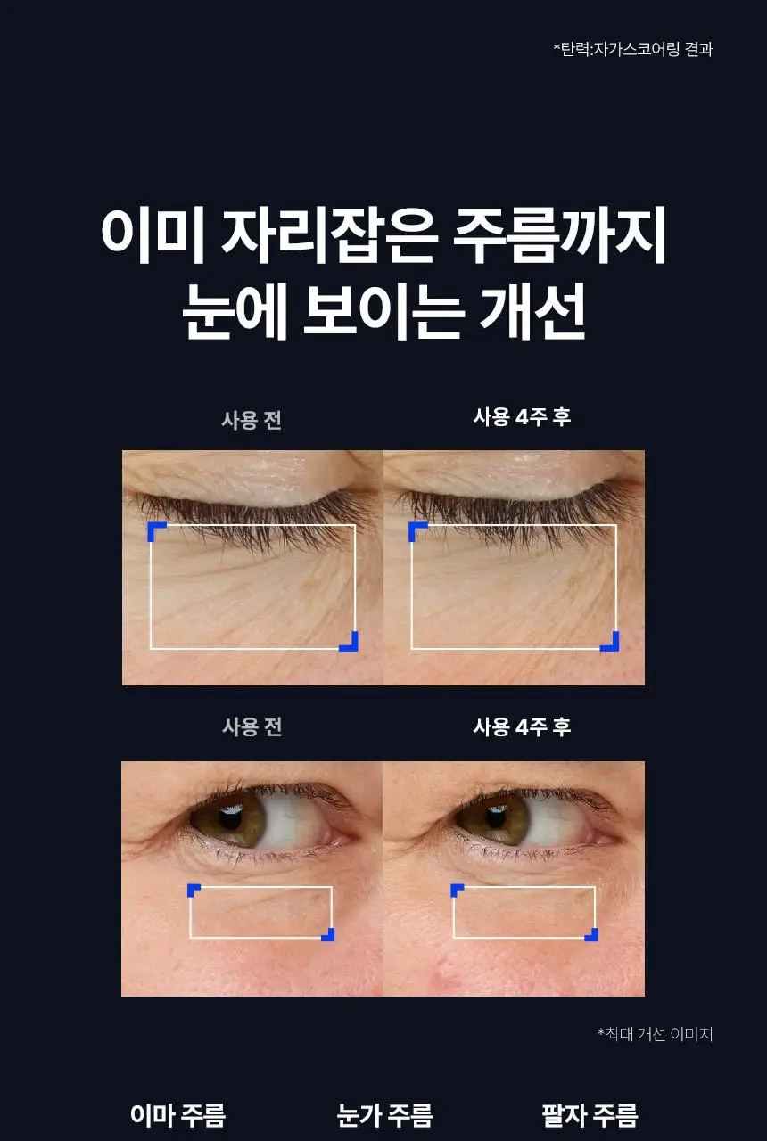 아이오페 레티놀 레티젝션 세럼 30ml 기획 (+15ml) 상세페이지 10